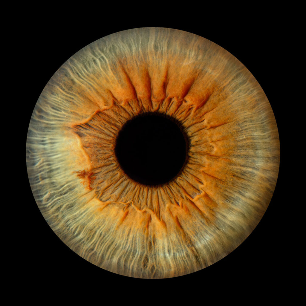 Les bidons de Lyon - Photo Iris œil