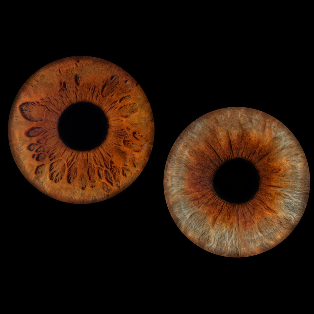 Les bidons de Lyon - Photo Iris œil