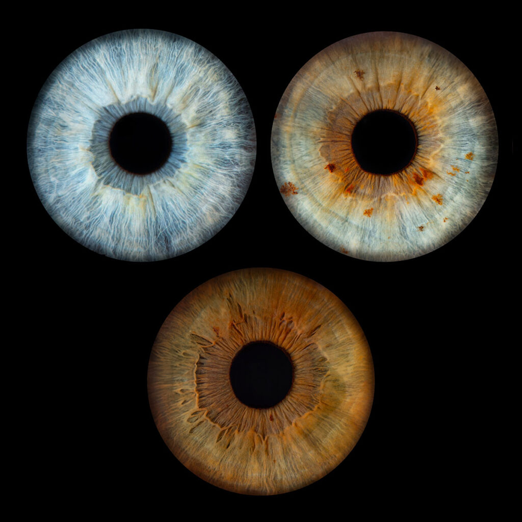 Les bidons de Lyon - Photo Iris œil