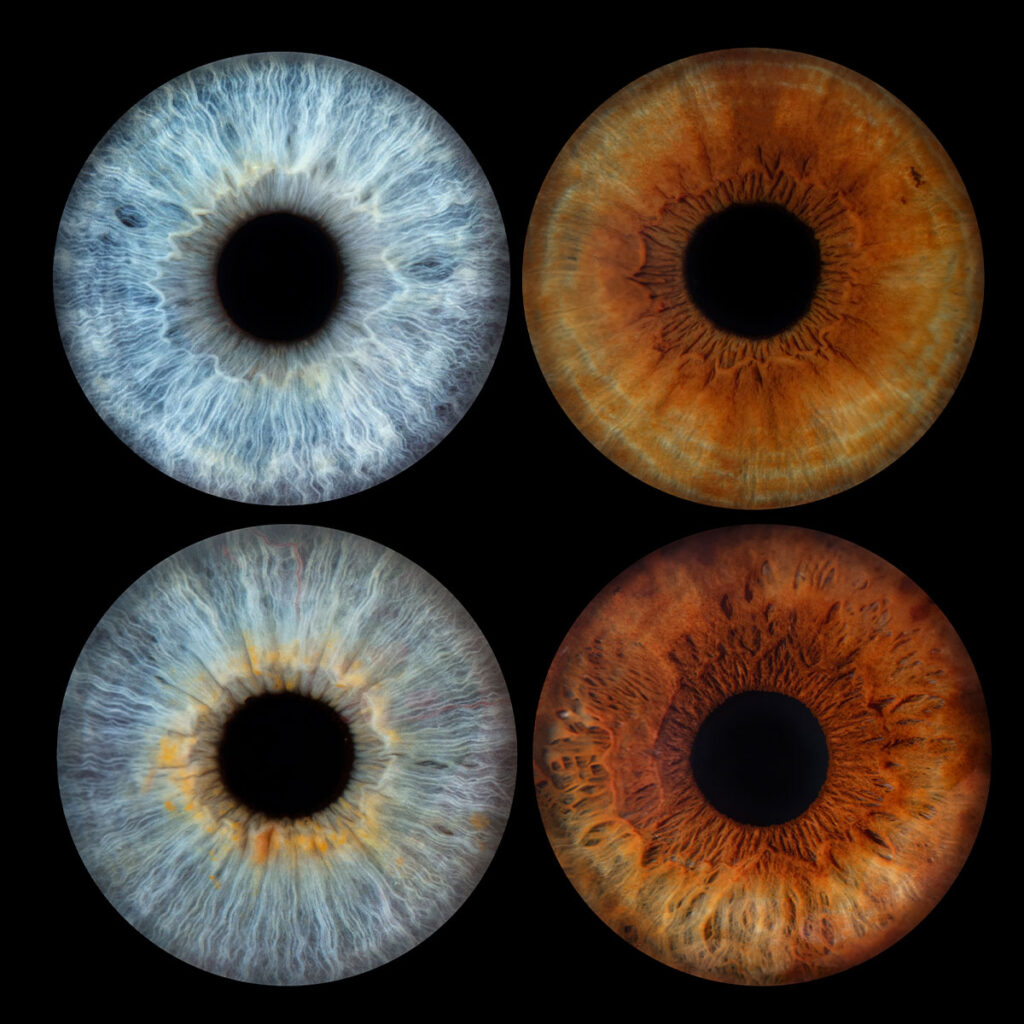 Les bidons de Lyon - Photo Iris œil