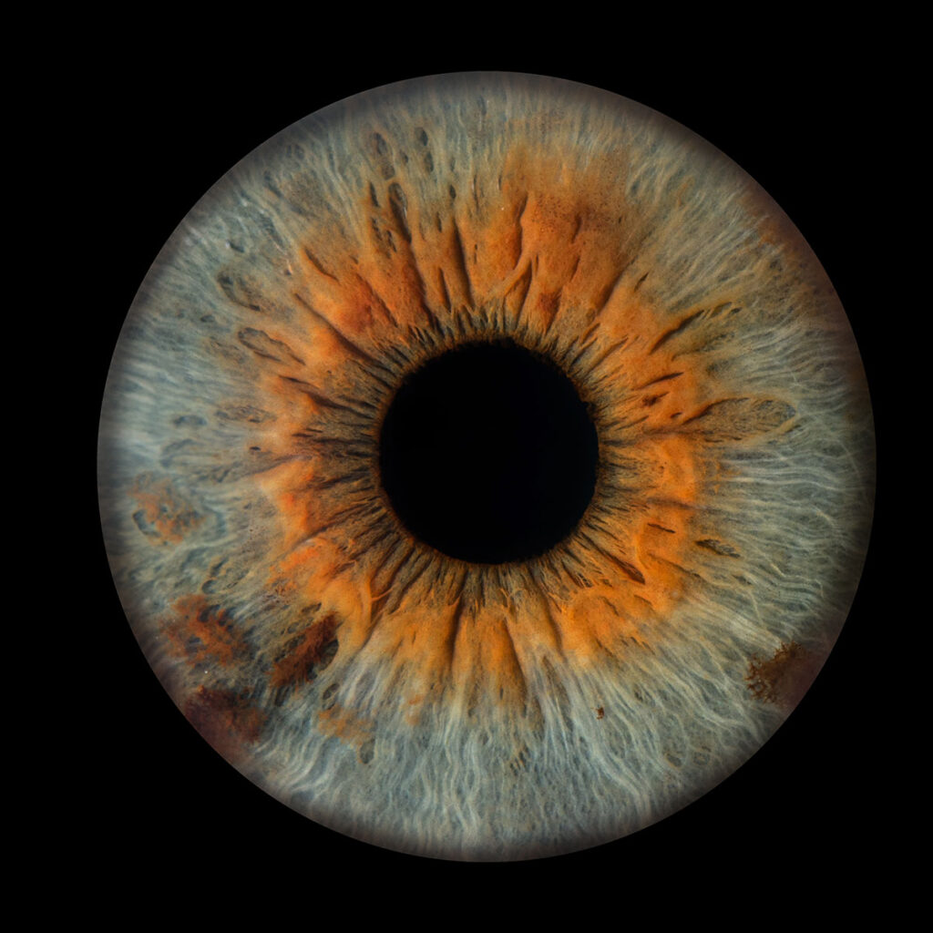 Les bidons de Lyon - Photo Iris œil