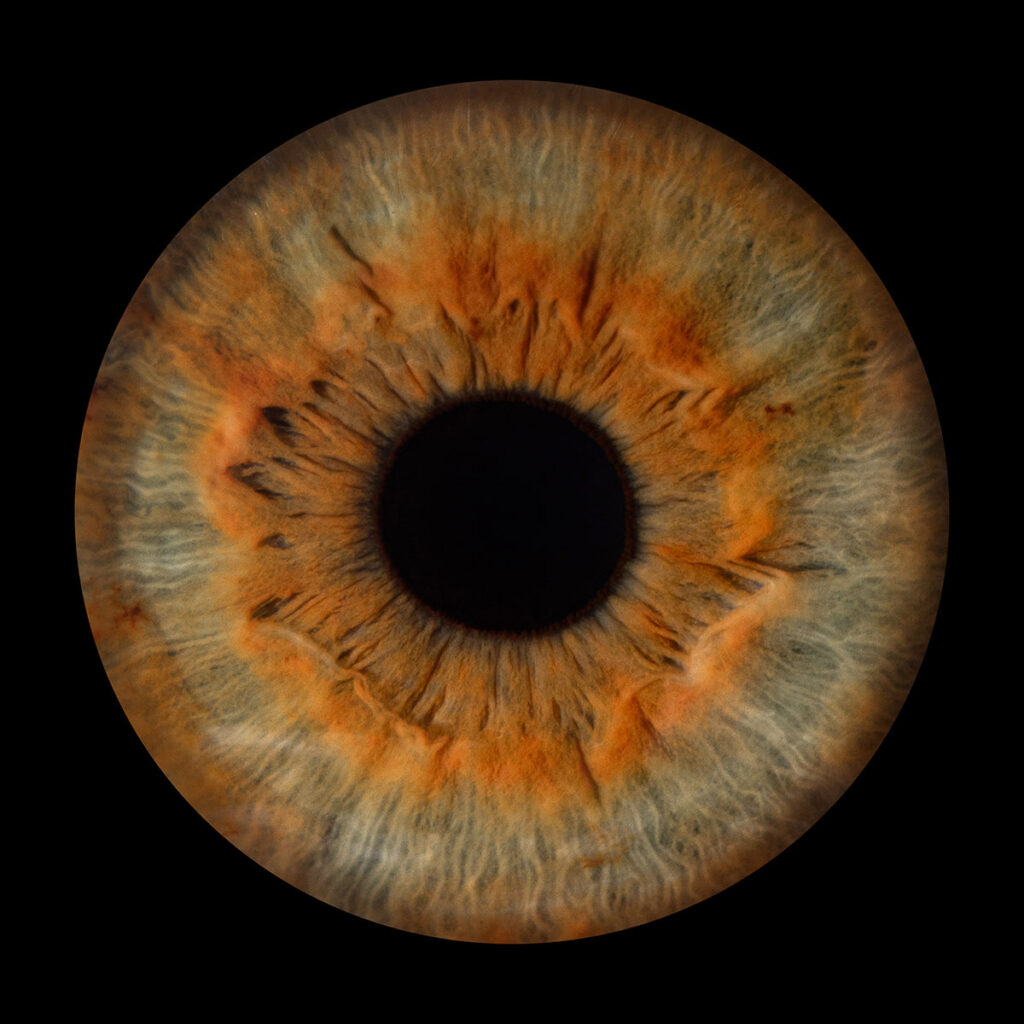 Les bidons de Lyon - Photo Iris œil