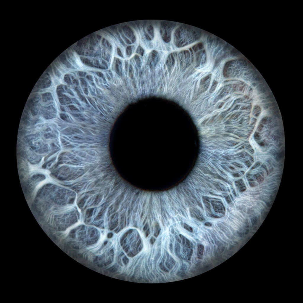 Les bidons de Lyon - Photo Iris œil