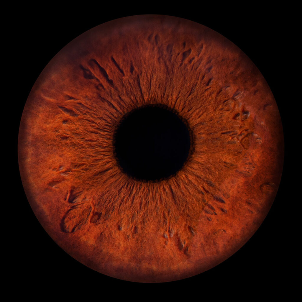 Les bidons de Lyon - Photo Iris œil