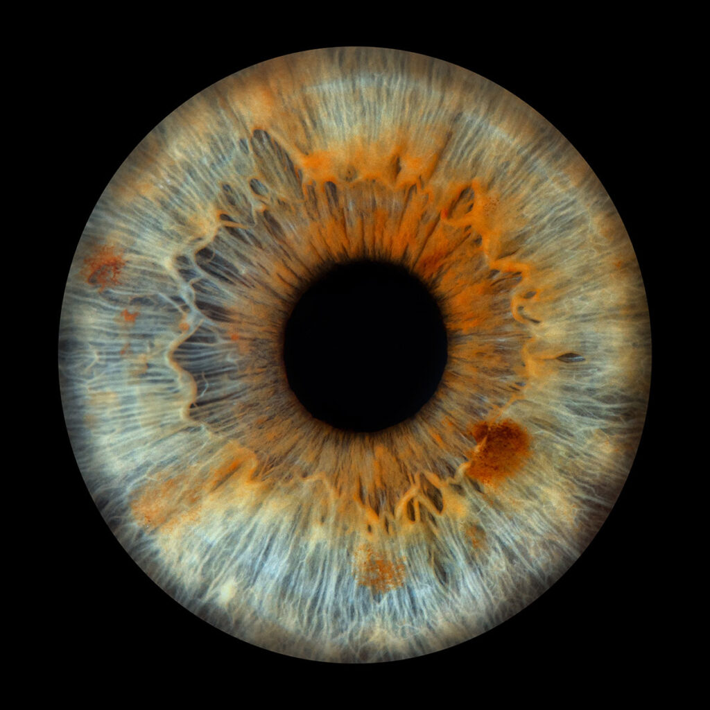 Les bidons de Lyon - Photo Iris œil