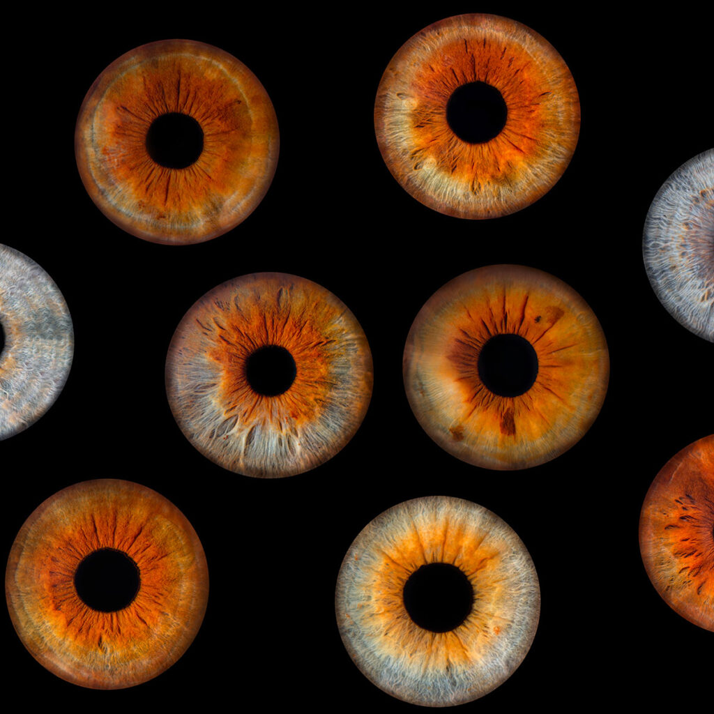 Les bidons de Lyon - Photo Iris œil