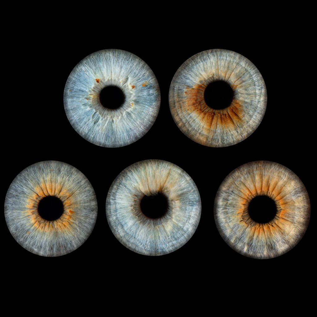 Les bidons de Lyon - Photo Iris œil